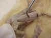 Bladder1.jpg (17450 bytes)