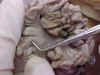 mesentery.jpg (29816 bytes)