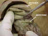 pancreas2.jpg (38562 bytes)