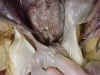 rectum.jpg (41373 bytes)