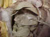 stomach.jpg (35267 bytes)