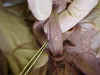 umbilartery.jpg (30744 bytes)