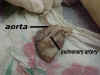 aorta2.jpg (39177 bytes)