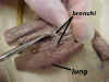 bronchi.jpg (43470 bytes)