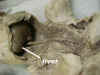 liver.jpg (40856 bytes)