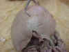 liverremoved.jpg (24288 bytes)