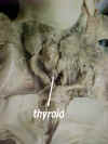 thyroid.jpg (34773 bytes)